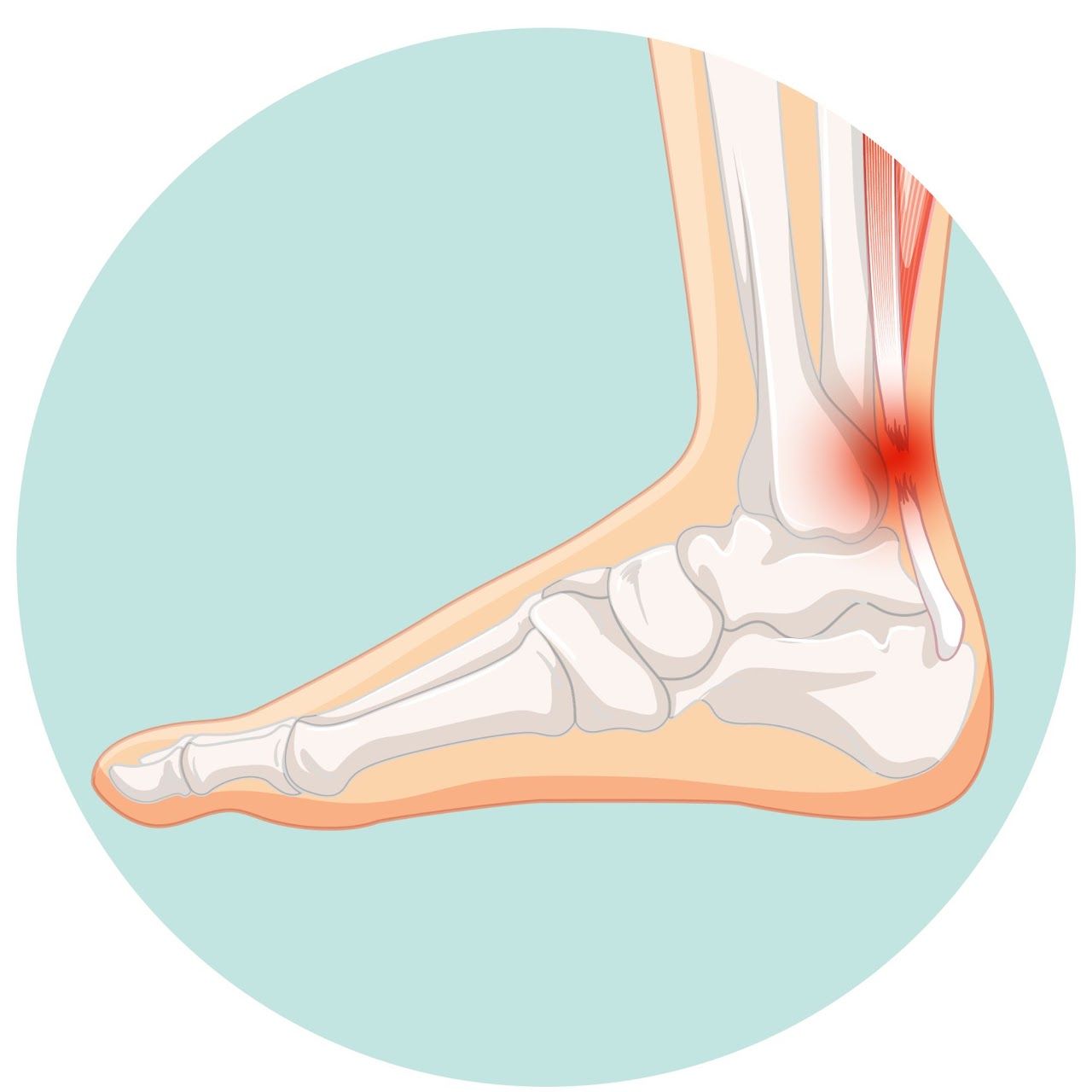 Soft Tissue Conditions